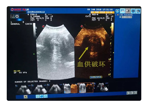 956440ee-f1ef-469d-9a64-c72d920f93a1.jpg 956440ee-f1ef-469d-9a64-c72d920f93a1.jpg